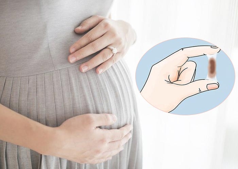 Polyp cổ tử cung bị hoại tử khi mang thai nguy hiểm như thế nào? 2