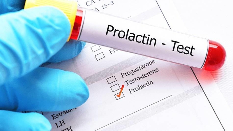 prolactin-mau-thap-canh-bao-dieu-gi-co-nguy-hiem-khong 1