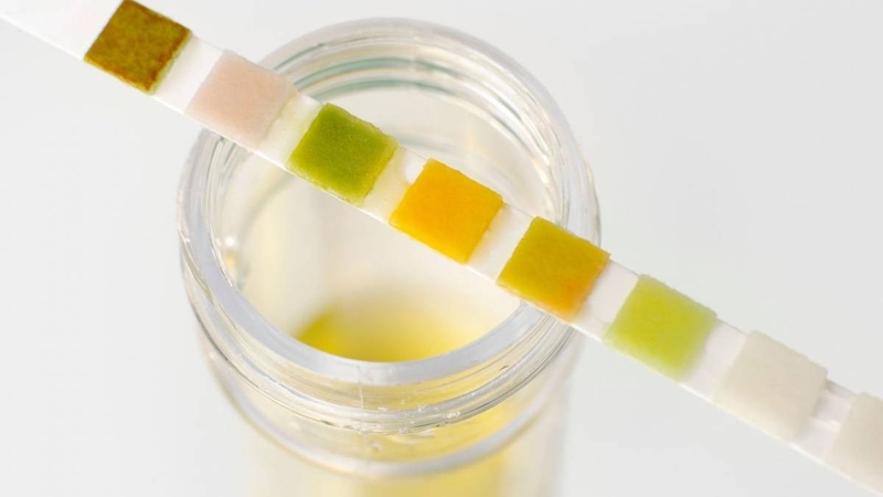 Bạn có biết nên ăn gì để giảm protein trong nước tiểu? 1