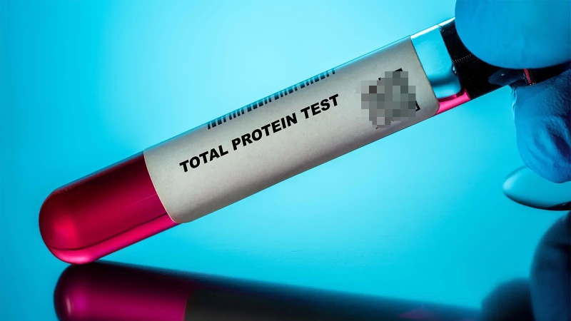 Tìm hiểu và xét nghiệm protein toàn phần 1