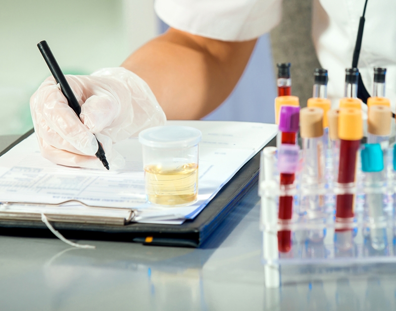 Tìm hiểu và xét nghiệm protein toàn phần 2