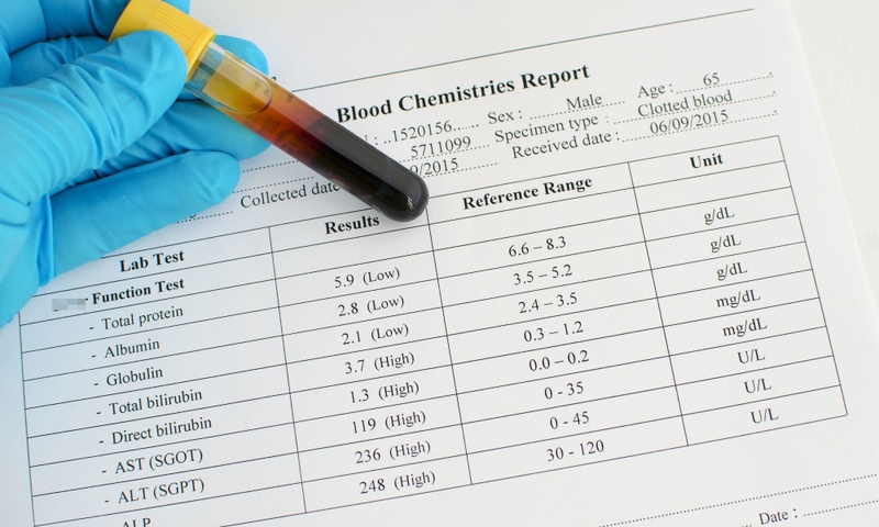 Tìm hiểu và xét nghiệm protein toàn phần 3