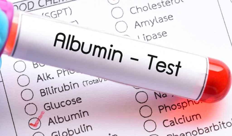 Protein toàn phần là gì? Những điều cần biết về xét nghiệm protein toàn phần 2