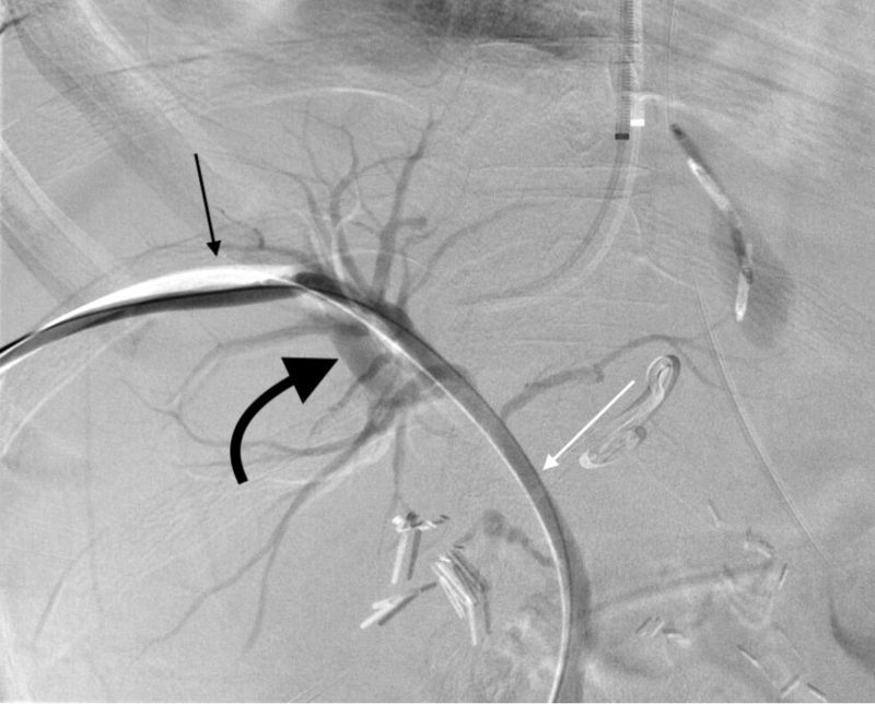 ptbd-duong-mat-la-gi-va-mot-so-thong-tin-can-biet-ve-ptbd-duong-mat 1.jpg