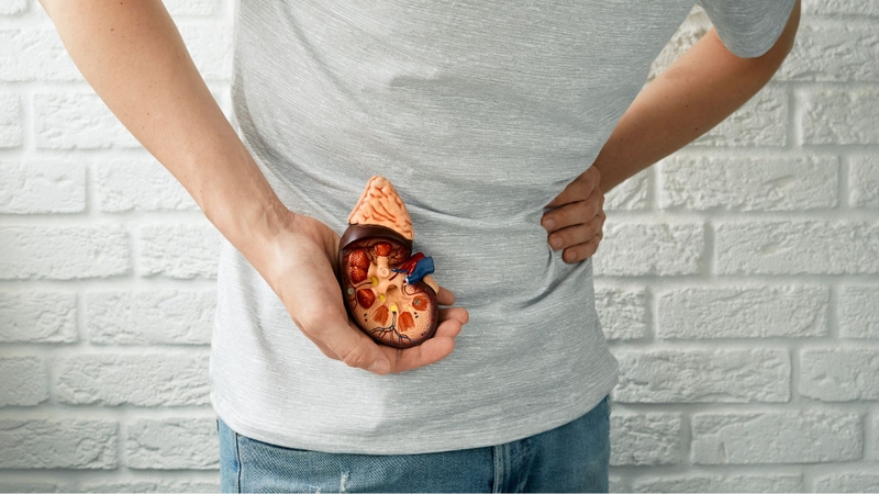 Sỏi thận là một trong những nguy cơ có thể gặp khi tiêu thụ khế quá mức