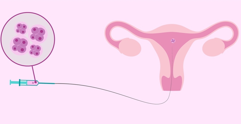 Quá trình IVF, giai đoạn sau chuyển phôi bị sốt có sao không? 1
