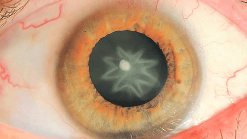 Quáng gà có nguy hiểm không? 1