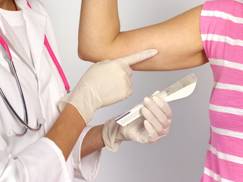 Que cấy tránh thai Implanon có tốt không? Có đắt không 2