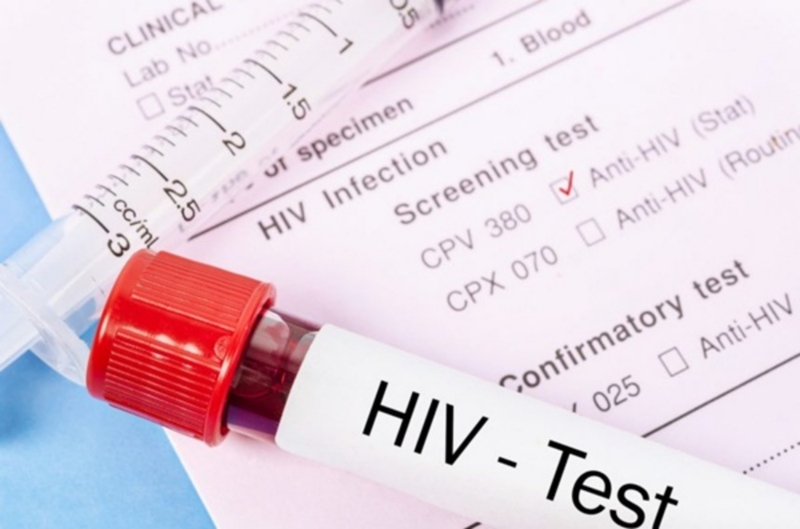 Que test HIV là gì? Những điều mà bạn cần lưu ý khi sử dụng que test HIV 2
