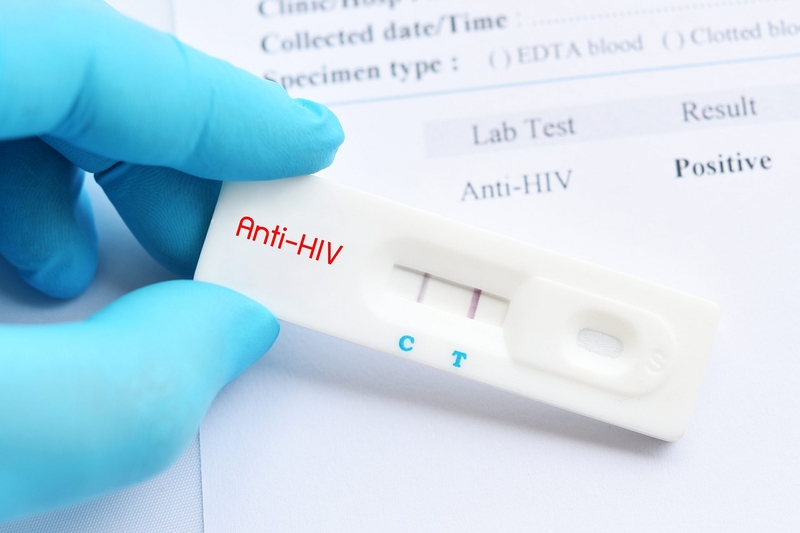 Que test HIV là gì? Những điều mà bạn cần lưu ý khi sử dụng que test HIV 3