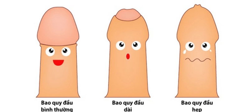 Quy đầu nhạy cảm là gì? Cách cải thiện tình trạng quy đầu nhạy cảm 3