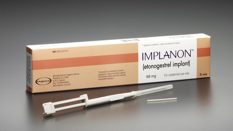 Quy trình cấy que tránh thai tiến hành như thế nào? Có an toàn không? 2