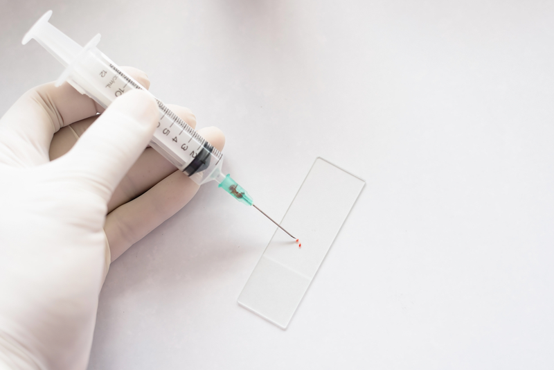 Quy trình chọc hút tế bào khối u vú và một số điều các chị em nên biết2