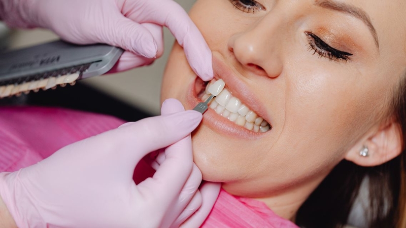 Nha sĩ kiểm tra hình dáng và màu sắc răng cần phục hình