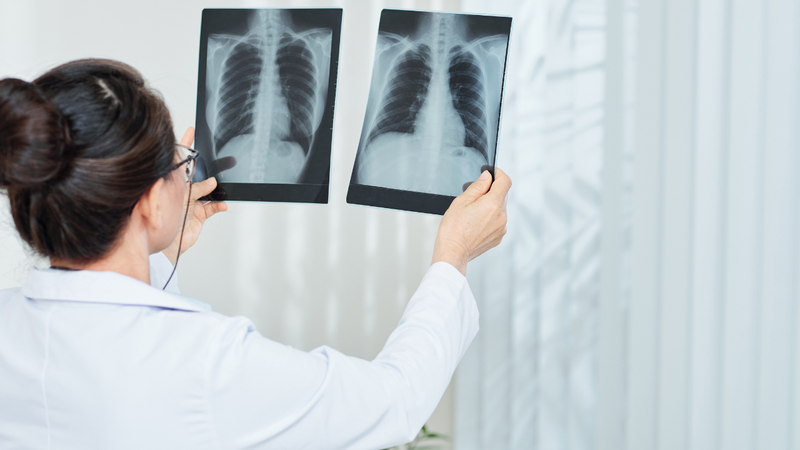 Quy trình khám và chữa bệnh tại Bệnh viện Phổi Hải Dương 1