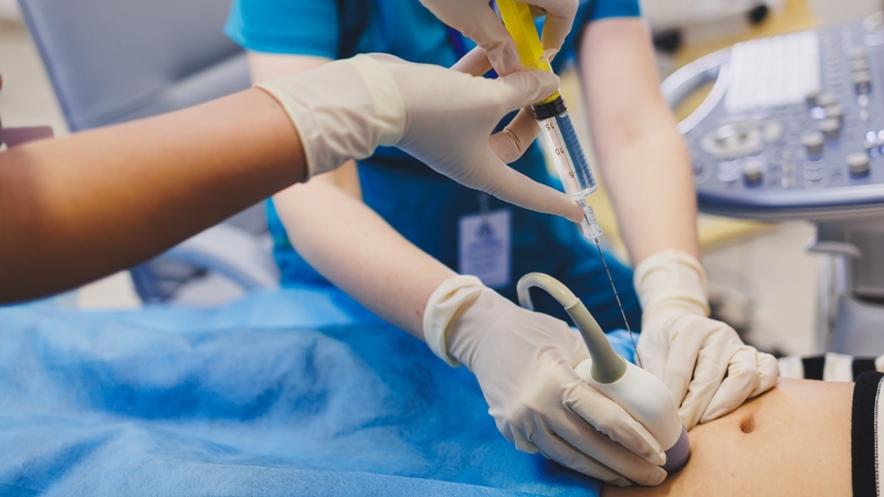 Chọc hút dịch màng bụng giúp thu thập mẫu dịch trong ổ bụng để hỗ trợ chẩn đoán bệnh