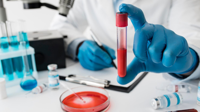 Quy trình nhổ răng khôn có cần xét nghiệm máu không? 2