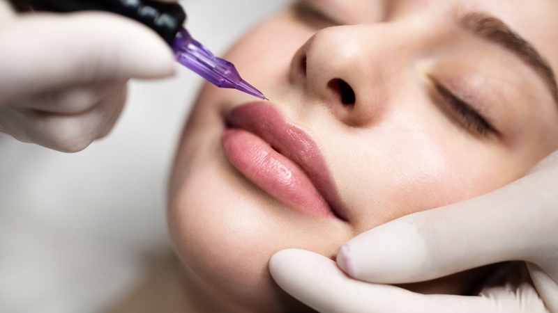 Quy trình phục hồi môi sau dặm môi lần 2 như thế nào? 2
