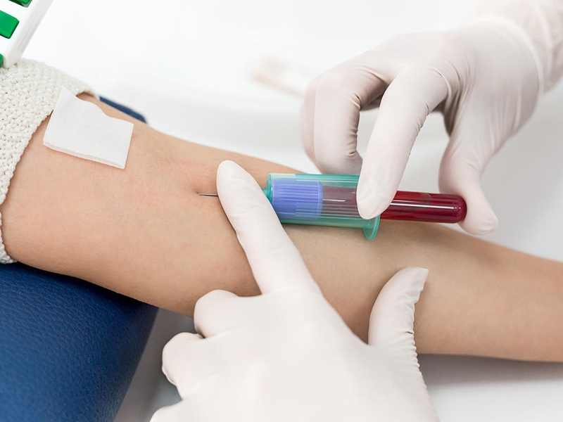 Quy trình test tiểu đường thai kỳ mà mẹ bầu nên biết 2