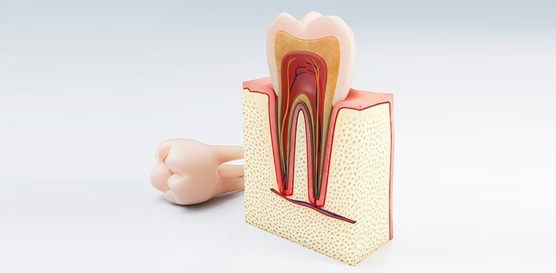 quy-trinh-thuc-hien-dieu-tri-tuy-rang-bang-may 1.jpg