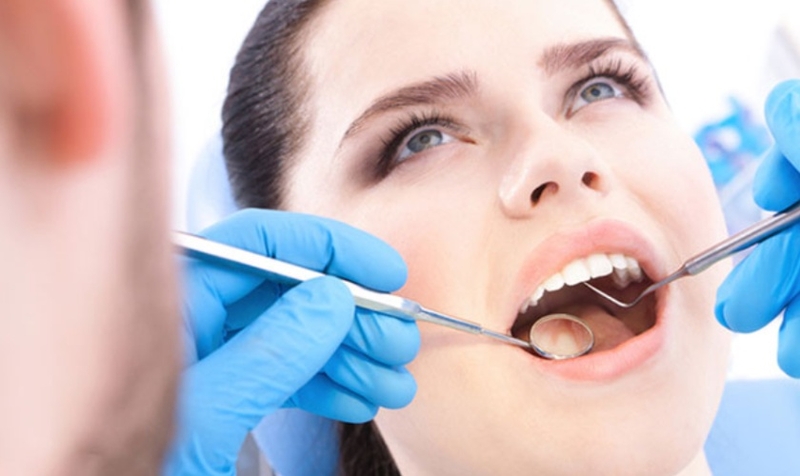 Quy trình trồng răng Implant như thế nào? Những thông tin cần biết 2