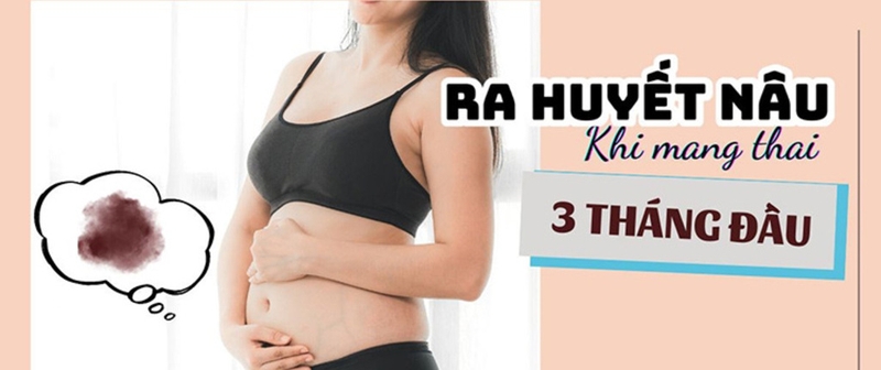 Ra huyết nâu khi mang thai 3 tháng đầu: Nguyên nhân và cách khắc phục 3