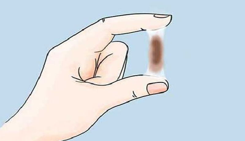 Ra khí hư màu nâu có phải mang thai không? Những điều cần biết về máu báo thai 1