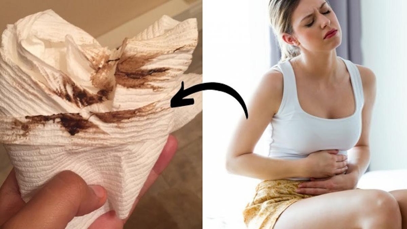 Ra khí hư màu nâu lẫn máu là bị bệnh gì? Làm sao xử lý tình trạng này? 3