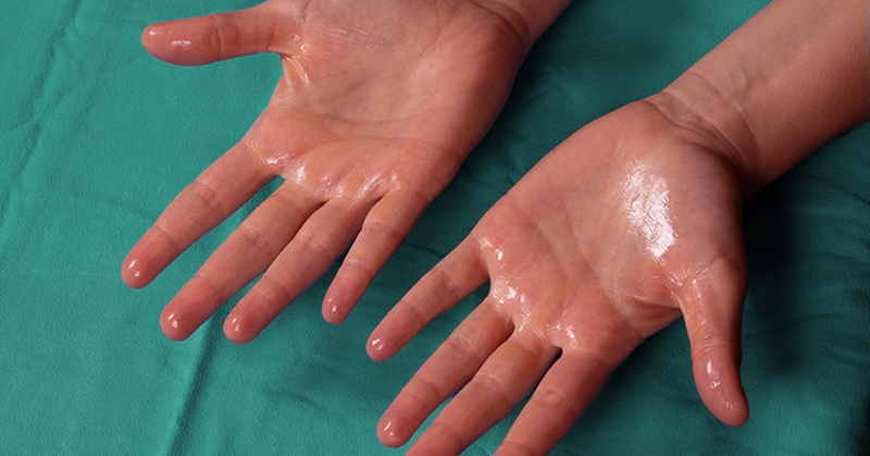 Ra mồ hôi tay chân có nguy hiểm không