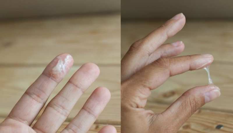 Ra nhiều khí hư màu trắng trong phải làm sao? 4