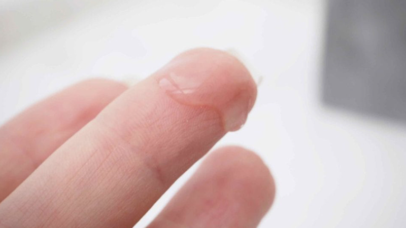 Ra nhiều khí hư màu trắng trong phải làm sao? 1