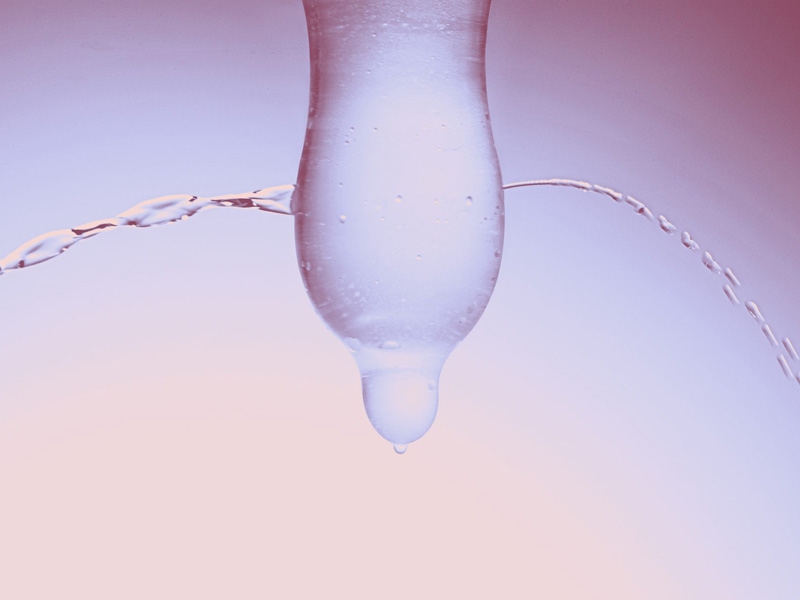 Tỷ lệ rách bao cao su không nhiều