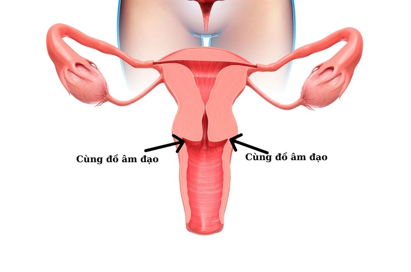 Rách cùng đồ âm đạo: Nguyên nhân, triệu chứng, cách điều tr 1