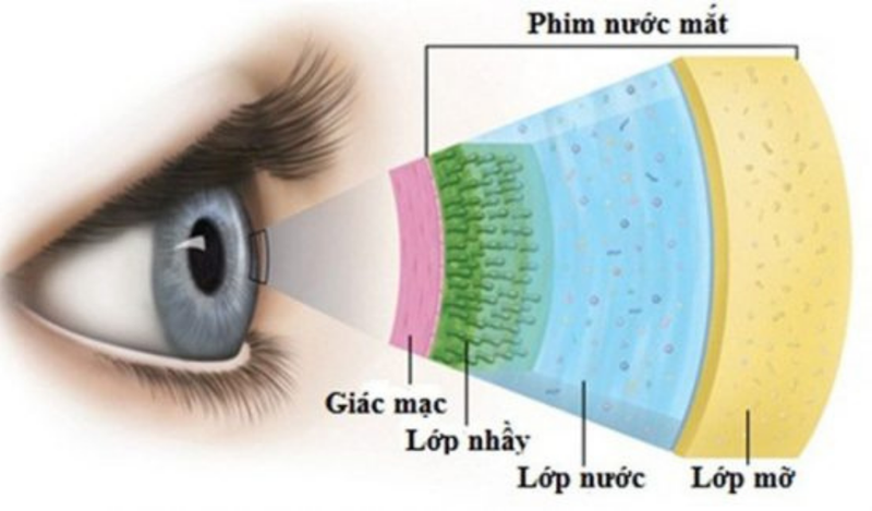 rách giác mạc là gì?