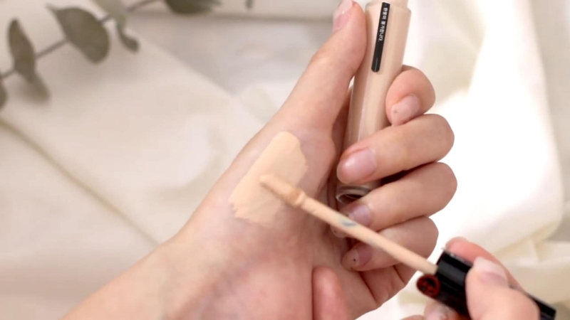 Rạn da tuổi dậy thì có hết không? 3