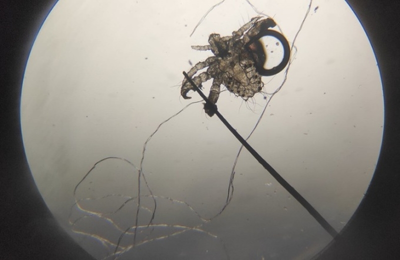 Rận mu lây qua đường gì 2