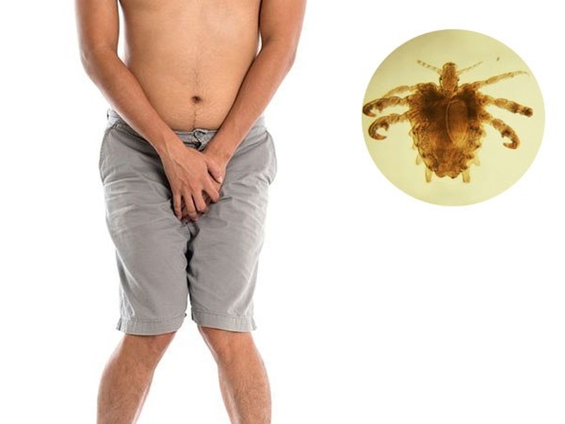 Rận mu ở nam giới: Những thông tin cần biết 2