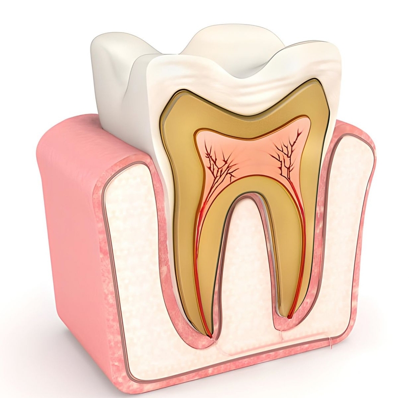 Răng bị mẻ: Nguyên nhân và triệu chứng bị mẻ răng 2