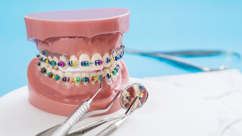 Các khí cụ chỉnh nha có thể tạo cạnh sắc hoặc gây cọ xát vào lưỡi