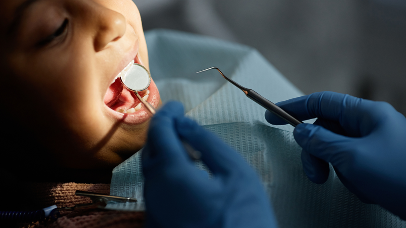 Nếu không thể bảo tồn, bác sĩ có thể chỉ định nhổ răng