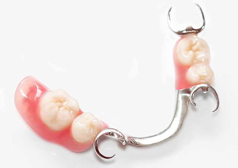 Răng giả tháo lắp loại nào tốt nhất trên thị trường? 3