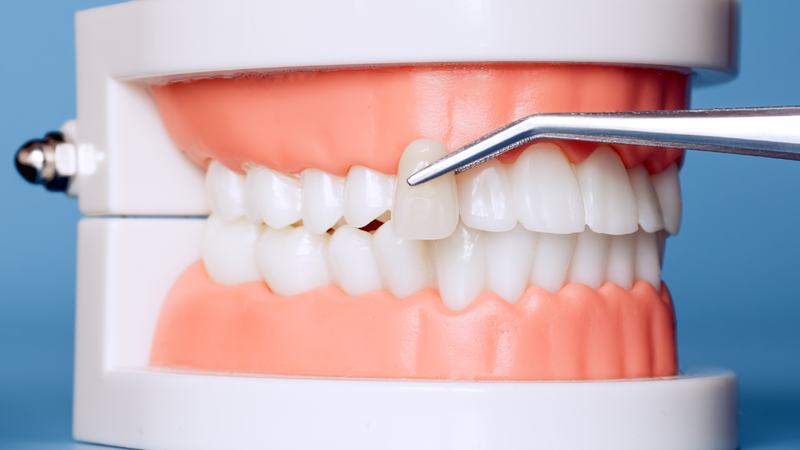 Lựa chọn đúng vật liệu giúp hạn chế các biến chứng không mong muốn