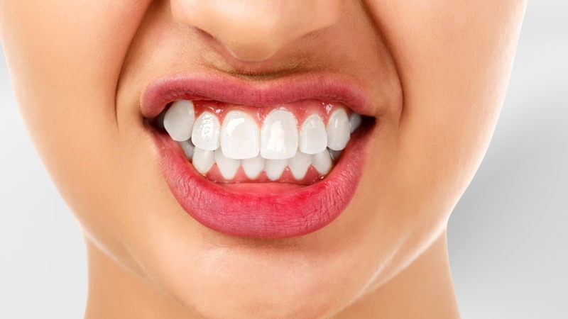 Có thể giữ răng khểnh nếu lệch nhẹ và không ảnh hưởng khớp cắn, chức năng nhai