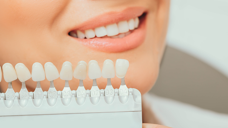 rang-ngan-co-nieng-duoc-khong-nguyen-nhan-rang-ngan (3).png