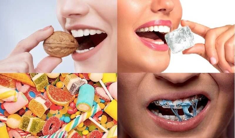 Răng sâu nặng có trám được không? Các biện pháp ngăn ngừa sâu răng không phải ai cũng biết 2