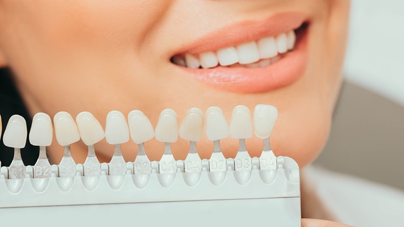 Răng sứ Katana có mấy loại? Ưu điểm của răng sứ Katana 2