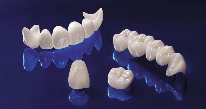 Răng sứ Katana là gì? Có nên lắp răng sứ Katana hay không? 1