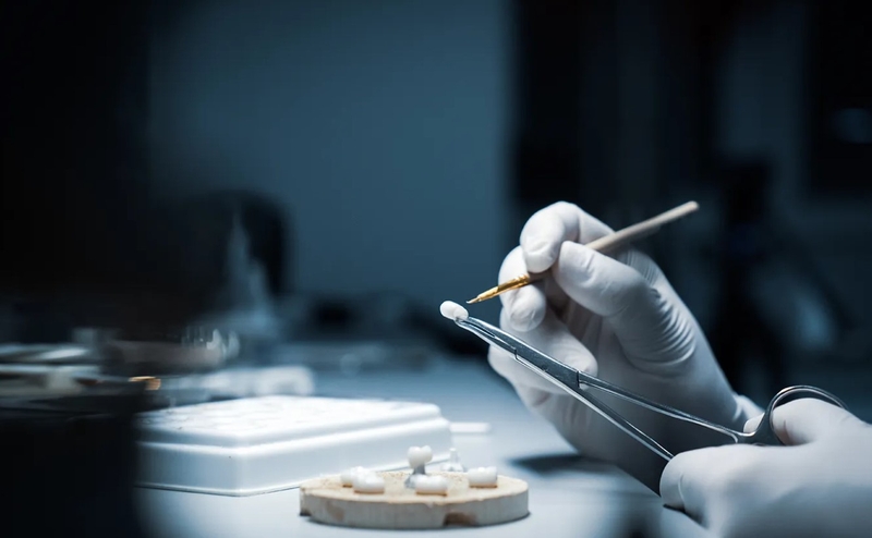 Răng sứ kim cương là gì? Ưu và nhược điểm của loại răng này 3