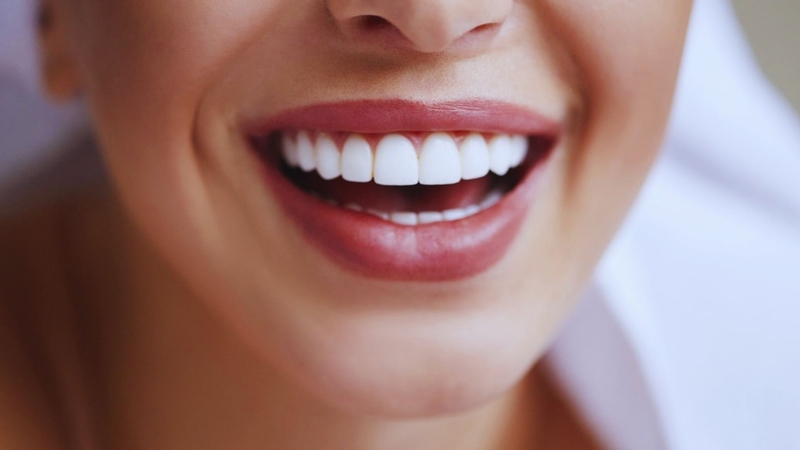 Răng sứ kim loại là gì? Có những loại nào và lợi ích ra sao? 1