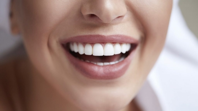 Răng sứ pha lê có tốt không? Có bền không? 2